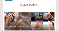 Desktop Screenshot of curatuacne.com